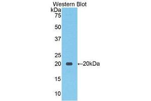 Western Blotting (WB) image for anti-Solute Carrier Family 12 (Sodium/Chloride Transporters), Member 3 (SLC12A3) (AA 867-1024) antibody (ABIN1859969) (SLC12A3 抗体  (AA 867-1024))
