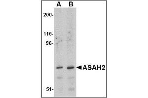 Western blot analysis of ASAH2 in 293 cell lysate with ASAH2 antibody at (A) 1 and (B) 2 µg/ml. (ASAH2 抗体  (C-Term))