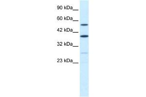 WB Suggested Anti-DXYS155E Antibody Titration:  0. (SFRS17A 抗体  (N-Term))