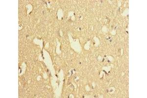 Immunohistochemistry of paraffin-embedded human brain tissue using ABIN7174279 at dilution of 1:100 (USP2 抗体  (C-Term))