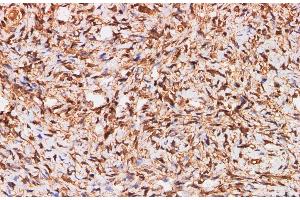 Immunohistochemistry of paraffin-embedded Human ovary using S100A11 Polyclonal Antibody at dilution of 1:200 (S100A11 抗体)