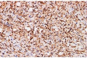Immunohistochemistry of paraffin-embedded Human ovary using S100A11 Polyclonal Antibody at dilution of 1:200 (S100A11 抗体)