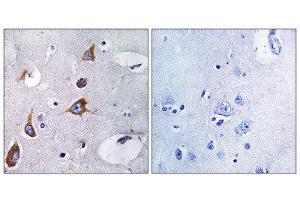 Immunohistochemistry (IHC) image for anti-Chondroitin Sulfate Synthase 1 (CHSY1) (Internal Region) antibody (ABIN1851106) (CHSY1 抗体  (Internal Region))