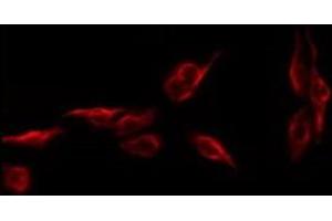 ABIN6279501 staining CoLo by IF/ICC. (NKX6-1 抗体  (Internal Region))