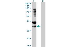 Western Blot analysis of TNFRSF14 expression in transfected 293T cell line by TNFRSF14 monoclonal antibody (M01), clone 2G6-2C7. (HVEM 抗体  (AA 38-283))