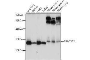 Western blot analysis of extracts of various cell lines, using TRMT112 antibody (ABIN7271001) at 1:3000 dilution.