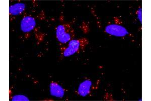 Proximity Ligation Assay (PLA) image for anti-Signal Transducer and Activator of Transcription 3 (Acute-Phase Response Factor) (STAT3) (AA 670-769) antibody (ABIN563028)