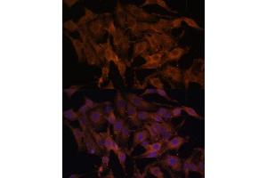Immunofluorescence (IF) image for anti-Toll-Like Receptor 3 (TLR3) (AA 464-647) antibody (ABIN6149219)