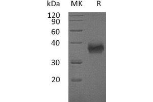 CD84 Protein (CD84) (His tag)