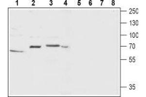Tachykinin Receptor 1 (TACR1) peptide