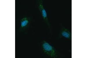 IF analysis of UBC12/UBE2M using anti-UBC12/UBE2M antibody (ABIN7600885). (UBE2M 抗体  (AA 25-154))