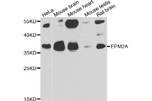 Western blot analysis of extracts of various cell lines, using EPM2A antibody (ABIN5974214) at 1/1000 dilution. (EPM2A 抗体)