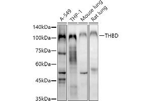Western blot analysis of extracts of various cell lines, using THBD antibody (ABIN1683026, ABIN3018621, ABIN3018622 and ABIN6220518) at 1:1000 dilution. (Thrombomodulin 抗体  (AA 200-500))