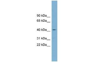 Western Blotting (WB) image for anti-Zinc Finger, DHHC-Type Containing 18 (ZDHHC18) (Middle Region) antibody (ABIN2775530)