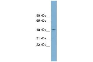WB Suggested Anti-ZDHHC18  Antibody Titration: 0. (ZDHHC18 抗体  (Middle Region))