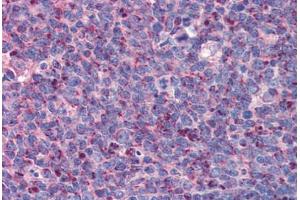 Human Tonsil: Formalin-Fixed, Paraffin-Embedded (FFPE) (IMP3 抗体  (C-Term))