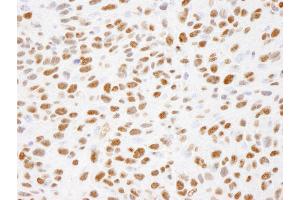 Immunohistochemistry (IHC) image for anti-X-Ray Repair Complementing Defective Repair in Chinese Hamster Cells 1 (XRCC1) (pSer485), (pThr488) antibody (ABIN7448871)