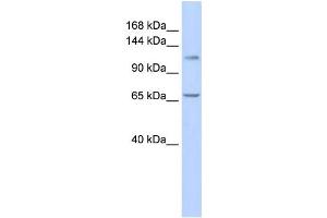 Western Blotting (WB) image for anti-Zinc Finger and BTB Domain-Containing Protein 10 (ZBTB10) antibody (ABIN2458201) (ZBTB10 抗体)