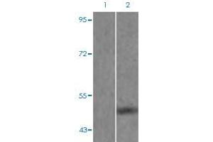 Western blot analysis of Lane 1: mouse brain tissue lysate preincubated with blocking peptide, Lane 2: mouse brain tissue lysate without blocking peptide by MAPT (phospho S262) polyclonal antibody  at 1:500-1:1000 dilution. (MAPT 抗体  (pSer262))