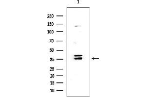 Western blot analysis of lysates from HUVEC cells, using IL1 alpha Mouse Monoclonal Antibody at 1/1000 dilution.