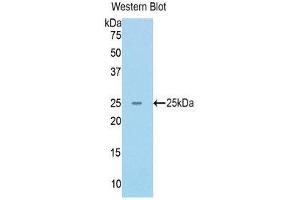 Western Blotting (WB) image for anti-RAD50 Homolog (S. Cerevisiae) (RAD50) (AA 400-595) antibody (ABIN1176803) (RAD50 抗体  (AA 400-595))