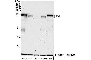 Western Blotting (WB) image for anti-AXL Receptor tyrosine Kinase (AXL) (AA 33-440) antibody (ABIN7453376)