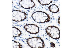 Immunohistochemistry of paraffin-embedded mouse pancreas using SOX9 Rabbit pAb (ABIN1682861, ABIN5664083, ABIN5664085 and ABIN6219552) at dilution of 1:100 (40x lens). (SOX9 抗体  (AA 100-200))