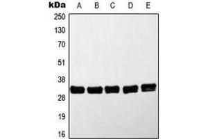 Western blot analysis of MYD88 expression in HeLa (A), Jurkat (B), K562 (C), Raji (D), Molt4 (E) whole cell lysates. (MYD88 抗体  (Center))