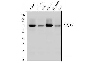 Western blot analysis of CPT1B using anti-CPT1B antibody (ABIN3042757). (CPT1B 抗体  (N-Term))