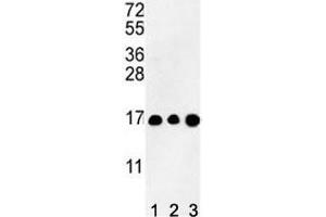 Western blot analysis of HIST3H3 antibody and (1) CEM, (2) K562, and (3) HL-60 lysate (Histone Cluster 3, H3 (HIST3H3) (AA 1-30) 抗体)