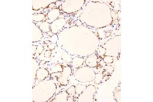 Immunohistochemical analysis of C on paraffin-embedded human thyroid tissue was performed on the Leica®BOND RXm.
