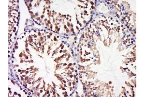 Paraformaldehyde-fixed, paraffin embedded mouse testis tissue, Antigen retrieval by boiling in sodium citrate buffer(pH6) for 15min, Block endogenous peroxidase by 3% hydrogen peroxide for 30 minutes, Blocking buffer (normal goat serum) at 37°C for 20min, Antibody incubation with Rabbit Anti-CCDC58 Polyclonal Antibody, Unconjugated  at 1:500 overnight at 4°C, followed by a conjugated secondary and DAB staining (CCDC58 抗体  (AA 71-144))