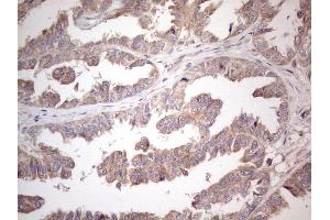 Immunohistochemistry (IHC) image for anti-Amelotin (AMTN) antibody (ABIN2716039) (Amelotin 抗体)