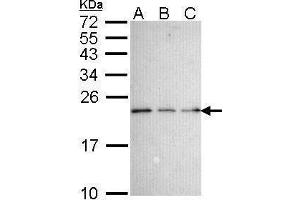 WB Image Sample (30 ug of whole cell lysate) A: 293T B: A431 , C: H1299 15% SDS PAGE antibody diluted at 1:1000 (Nerve Growth Factor Receptor (TNFRSF16) Associated Protein 1 (NGFRAP1) (Center) 抗体)