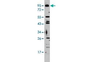 Western blot analysis of K-562 cell lysate (35 ug/lane) with Tlr6 polyclonal antibody .