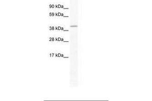 Image no. 1 for anti-GATA Binding Protein 5 (GATA5) (AA 321-370) antibody (ABIN202438)