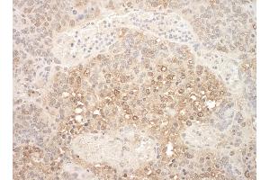 Immunohistochemistry (IHC) image for anti-Anaphase Promoting Complex Subunit 7 (ANAPC7) (AA 515-565) antibody (ABIN7448413) (ANAPC7 抗体  (AA 515-565))