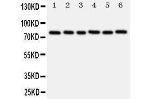 Anti-B MyB antibody, Western blotting Lane 1: Rat Spleen Tissue Lysate Lane 2: Rat Thymus Tissue Lysate Lane 3: Rat Brain Tissue Lysate Lane 4: HELA Cell Lysate Lane 5: COLO320 Cell Lysate Lane 6: MCF-7 Cell Lysate (MYBL2 抗体  (N-Term))
