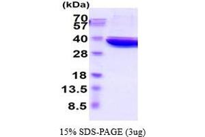 SDS-PAGE (SDS) image for Lactate Dehydrogenase A (LDHA) (AA 1-332) (Active) protein (His tag) (ABIN6387821) (Lactate Dehydrogenase A Protein (LDHA) (AA 1-332) (His tag))