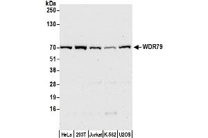 Western Blotting (WB) image for anti-WD Repeat Containing, Antisense To TP53 (WRAP53) (AA 1-50) antibody (ABIN7453892)
