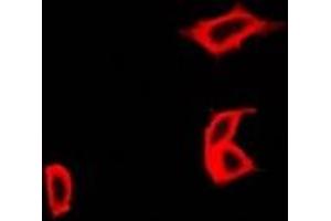 Immunofluorescent analysis of CCBL1 staining in Hela cells. (CCBL1 抗体)