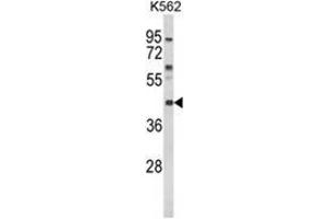 Western blot analysis of MC3R Antibody (Center) in K562 cell line lysates (35ug/lane). (MC3R 抗体  (Middle Region))