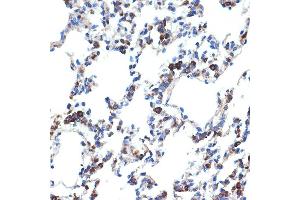 Immunohistochemistry of paraffin-embedded rat lung using ERp29 Rabbit mAb (ABIN7266943) at dilution of 1:100 (40x lens). (ERP29 抗体)