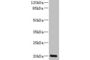 Western blot All lanes: ZMAT5 antibody at 5 μg/mL + Colo320 whole cell lysate Secondary Goat polyclonal to rabbit IgG at 1/10000 dilution Predicted band size: 20 kDa Observed band size: 20 kDa (ZMAT5 抗体  (AA 1-170))