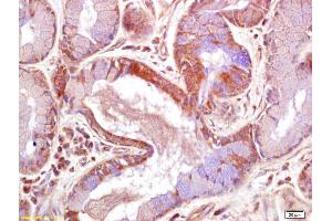 Formalin-fixed and paraffin embedded human skin labeled with Rabbit Anti JNK2 Polyclonal Antibody, Unconjugated (ABIN681403) at 1:200 followed by conjugation to the secondary antibody and DAB staining (JNK1/2 抗体  (AA 311-424))