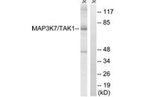 Western blot analysis of extracts from Jurkat cells, treated with heat shock, using MAP3K7 (Ab-187) Antibody. (MAP3K7 抗体  (AA 161-210))