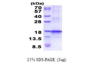 SDS-PAGE (SDS) image for Chemokine (C-C Motif) Ligand 25 (CCL25) (AA 24-150) protein (His tag) (ABIN5854118) (CCL25 Protein (AA 24-150) (His tag))