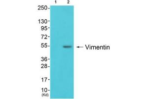 Western blot analysis of extracts from 293 cells (Lane 2), using Vimentin Antibody. (Vimentin 抗体  (C-Term))