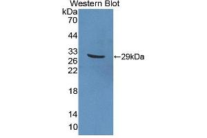 Western blot analysis of the recombinant protein. (PTPRN2 抗体  (AA 782-1001))