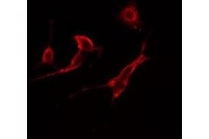 ABIN6277770 staining  HuvEc cells by IF/ICC. (CSNK2B 抗体  (Internal Region))